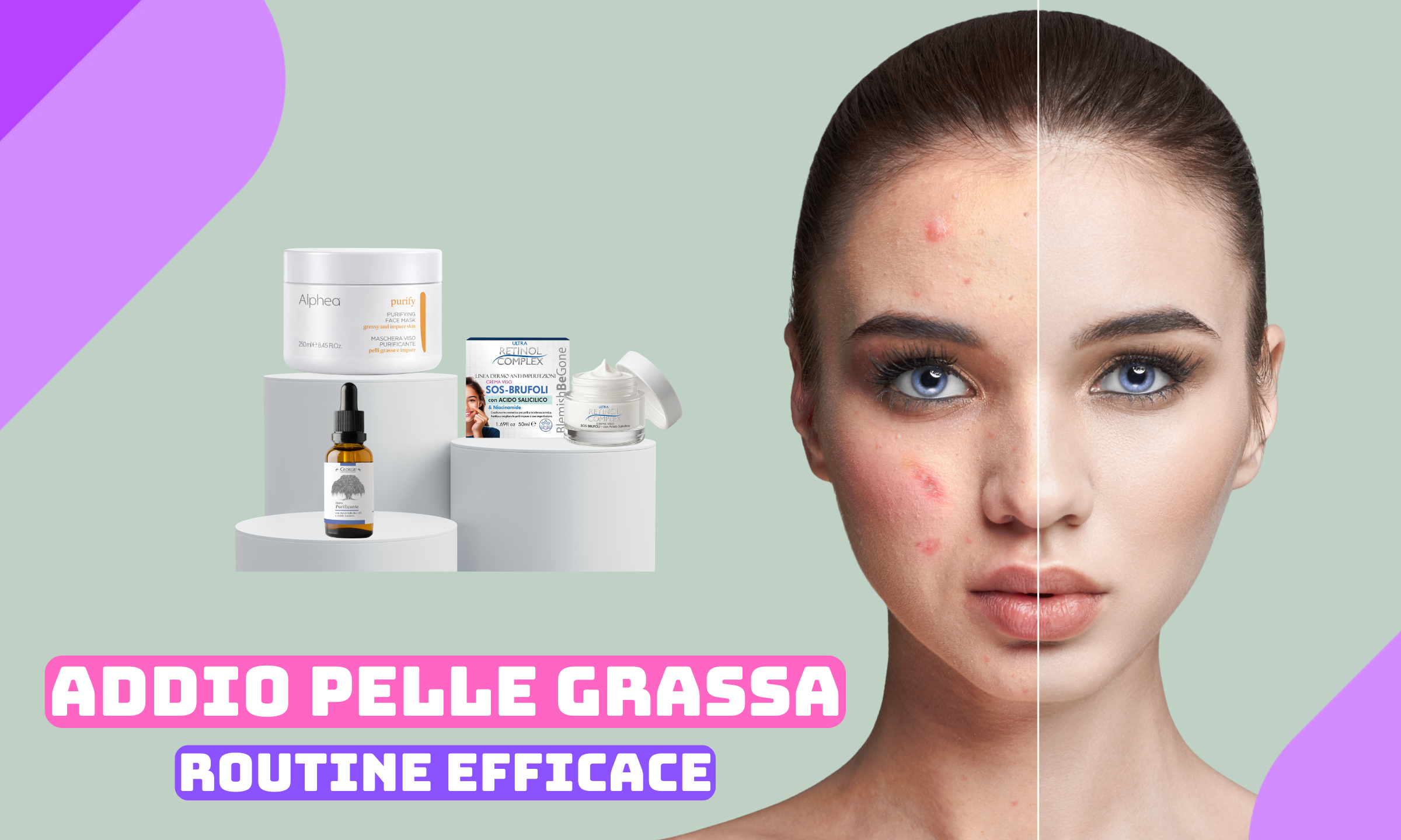 Pelle grassa e brufoli: cosa usare davvero